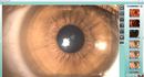 COS Starry Slit Lamp Imaging System