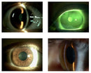 COS Starry Slit Lamp Imaging System